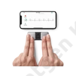 Kép 3/3 - ALIVECOR KardiaMobile 1-elvezetéses EKG telefoncsíptetővel 