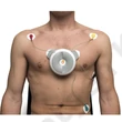 Kép 4/4 - D-HEART 8-12 csatornás EKG készülék