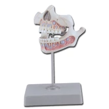 Tejfogak oktató modell - felső és alsó állkapocs - 5 éves gyerek