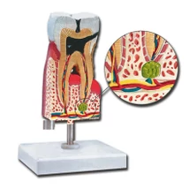 Alsó moláris fog oktató modell - 10X