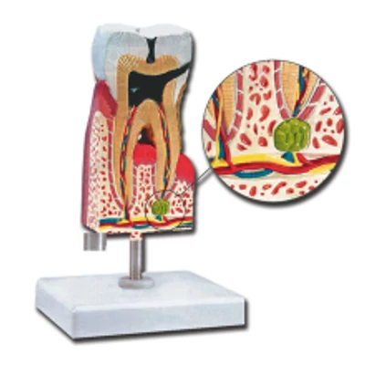 Alsó moláris fog oktató modell - 10X